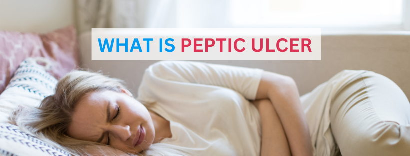 Peptic Ulcer: Symptoms, Causes & Treatment
