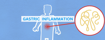 Gastric Inflammation: Symptoms, Causes, and Treatment